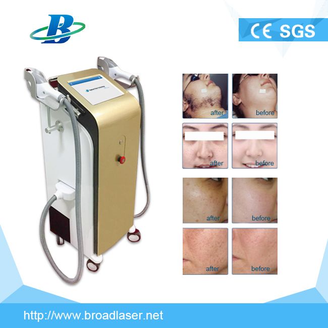 Powerful Body Hair Removal IPL Opt Vertical Type Machine